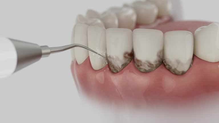 Trusted Teeth Cleaning And Checkup service in Jacksboro, TN - Dentist Open Now